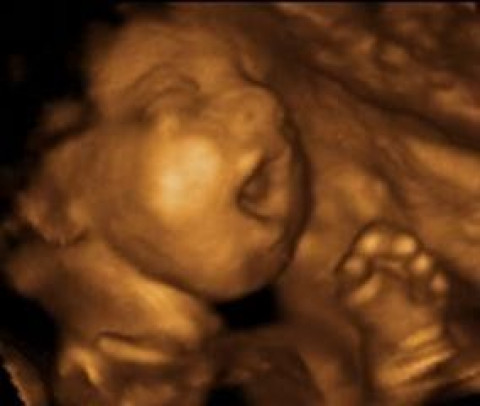 Visit A Little Inisght 3D 4D Ultrasound